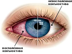 Покраснели глаза? Выключите кондюк! 