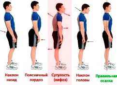 Главные враги осанки и главные методы борьбы 